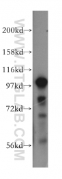15440-1-AP - LONP1 / PRSS15