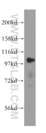 15440-1-AP - LONP1 / PRSS15