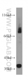 13224-1-AP - LRG1