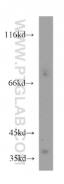 13224-1-AP - LRG1