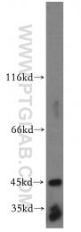 13224-1-AP - LRG1