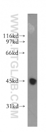 13224-1-AP - LRG1