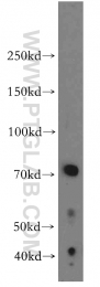 19498-1-AP - JAW1 / LRMP