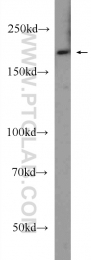 24899-1-AP - LRP5