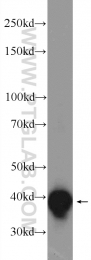 24662-1-AP - LRPAP1 / A2MRAP