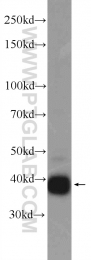 24662-1-AP - LRPAP1 / A2MRAP