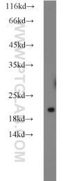 10259-1-AP - LSM1
