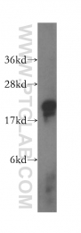 10259-1-AP - LSM1