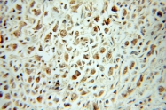 10963-1-AP - LSM2