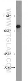 18216-1-AP - LSR / LISCH