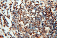 13662-1-AP - LTA4H