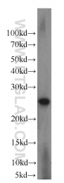 16055-1-AP - LYPLA1