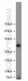 16055-1-AP - LYPLA1