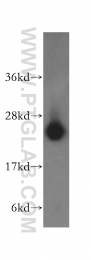 16055-1-AP - LYPLA1