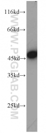 17430-1-AP - MAGT1