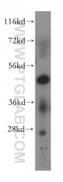 17505-1-AP - MAK16 / RBM13