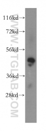 17505-1-AP - MAK16 / RBM13