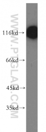 19974-1-AP - MAP3K10