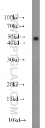 55309-1-AP - MAT2A