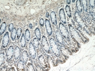 15120-1-AP - METTL9 / DREV