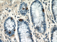 15120-1-AP - METTL9 / DREV