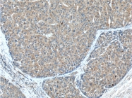 15120-1-AP - METTL9 / DREV