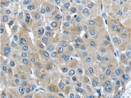 15120-1-AP - METTL9 / DREV