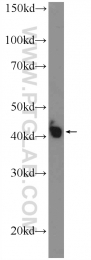 15120-1-AP - METTL9 / DREV