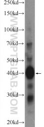 15120-1-AP - METTL9 / DREV