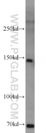 21166-1-AP - Myocardin-Like Protein 1