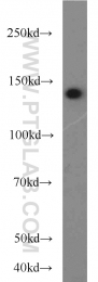21166-1-AP - Myocardin-Like Protein 1