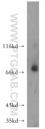 17874-1-AP - MMP-8