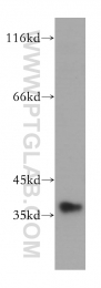 11719-1-AP - MNAT1 / RNF66