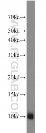 17884-1-AP - Mpv17-like protein / MPV17L