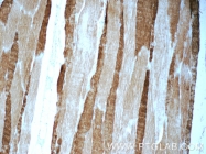 25182-1-AP - Myosin-1 / MYH1