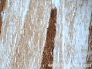 25182-1-AP - Myosin-1 / MYH1