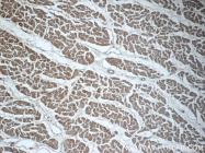 22281-1-AP - MYH6 / Myosin 6