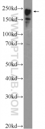 22281-1-AP - MYH6 / Myosin 6