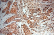 18934-1-AP - Neurofilament H (200 kD)
