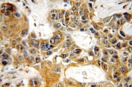 18934-1-AP - Neurofilament H (200 kD)