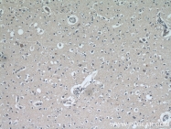 18934-1-AP - Neurofilament H (200 kD)