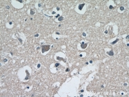 18934-1-AP - Neurofilament H (200 kD)