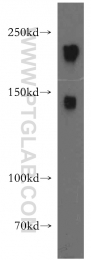 18934-1-AP - Neurofilament H (200 kD)
