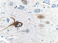 21471-1-AP - Neurofilament H (200 kD)