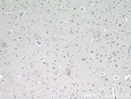 21471-1-AP - Neurofilament H (200 kD)