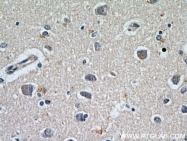 21471-1-AP - Neurofilament H (200 kD)