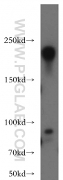21471-1-AP - Neurofilament H (200 kD)