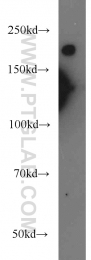 21471-1-AP - Neurofilament H (200 kD)