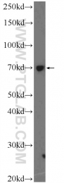 14014-1-AP - NFKBIZ / IKBZ