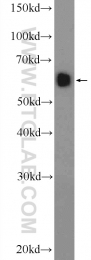 14014-1-AP - NFKBIZ / IKBZ